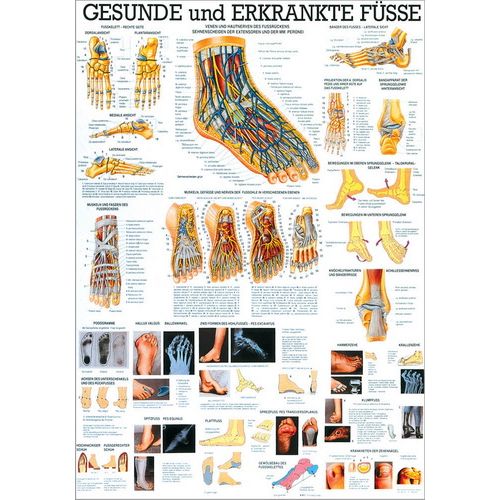 Lehrtafel Gesunde und Erkrankte Füsse