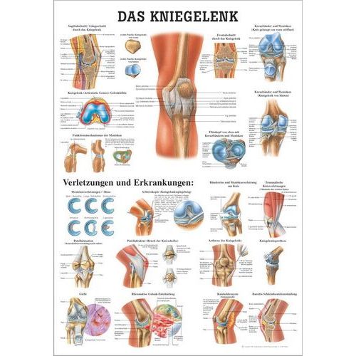 Lehrtafel Das Kniegelenk